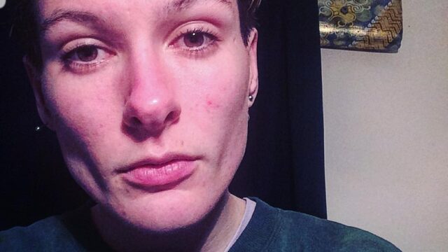 Long Covid - What Chronic Fatigue Taught Me